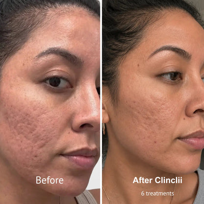 PDRN Micro-Penetration Care System | Revitalize Your Skin's Natural Radiance