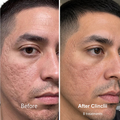 PDRN Micro-Penetration Care System | Revitalize Your Skin's Natural Radiance
