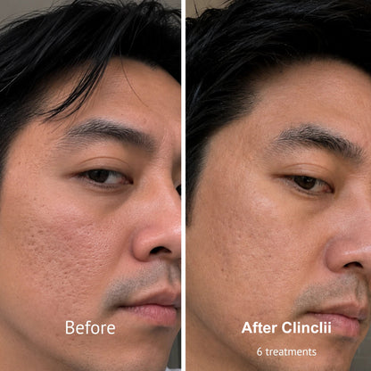 PDRN Micro-Penetration Care System | Revitalize Your Skin's Natural Radiance